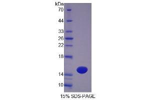 SDS-PAGE (SDS) image for Otoraplin (OTOR) (AA 17-121) protein (His tag) (ABIN6239192) (Otoraplin Protein (OTOR) (AA 17-121) (His tag))