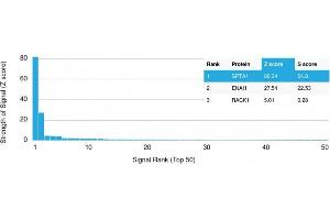 Analysis of Protein Array containing more than 19,000 full-length human proteins using Spectrin, alpha 1 Mouse Monoclonal Antibody (SPTA1/1810) Z- and S- Score: The Z-score represents the strength of a signal that a monoclonal antibody (MAb) (in combination with a fluorescently-tagged anti-IgG secondary antibody) produces when binding to a particular protein on the HuProtTM array. (SPTA1 Antikörper  (AA 356-475))