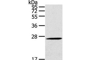 Western Blot analysis of Mouse liver tissue using CLEC4A Polyclonal Antibody at dilution of 1:100 (CLEC4A Antikörper)