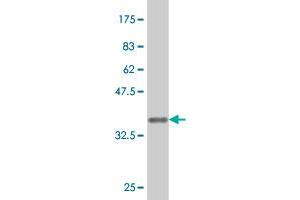 Western Blot detection against Immunogen (37. (FGFR1 Antikörper  (AA 303-408))