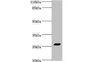 Western blot All lanes: TREM1 antibody at 2 μg/mL + HepG2 whole cell lysate Secondary Goat polyclonal to rabbit IgG at 1/10000 dilution Predicted band size: 27, 18, 26 kDa Observed band size: 27 kDa (TREM1 Antikörper  (AA 21-205))