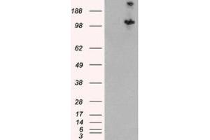 Western Blotting (WB) image for anti-Tuberous Sclerosis 1 (TSC1) (C-Term) antibody (ABIN2466406) (TSC1 Antikörper  (C-Term))