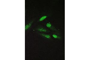 IF analysis of SRI using anti-SRI antibody (ABIN6719388) SRI was detected in immunocytochemical section of U20S cell. (SRI Antikörper)