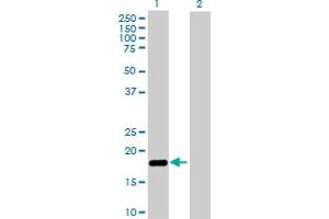 Western Blotting (WB) image for anti-Nudix (Nucleoside Diphosphate Linked Moiety X)-Type Motif 2 (NUDT2) (AA 1-147) antibody (ABIN513378)