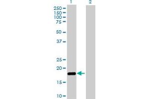 Western Blot analysis of NUDT2 expression in transfected 293T cell line by NUDT2 MaxPab polyclonal antibody. (NUDT2 Antikörper  (AA 1-147))