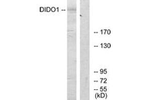 Western blot analysis of extracts from 293 cells, using DIDO1 Antibody. (DIDO1 Antikörper  (AA 161-210))