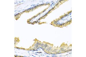 Immunohistochemistry of paraffin-embedded human prostate using PENK antibody.