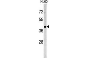 Western Blotting (WB) image for anti-Tumor-Associated Calcium Signal Transducer 2 (TACSTD2) antibody (ABIN3002746) (TACSTD2 Antikörper)