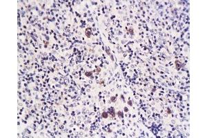 Formalin-fixed and paraffin embedded rat transplant lymphoma labeled with Anti-Caspase-1 Polyclonal Antibody, Unconjugated  at 1:200 followed by conjugation to the secondary antibody and DAB staining (Caspase 1 (p10) Antikörper  (AA 320-404))