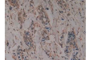 DAB staining on IHC-P; Samples: Human Stomach Tissue) (GLA Antikörper  (AA 81-429))