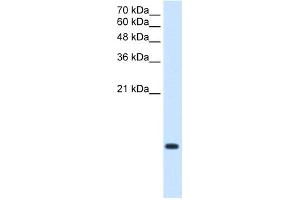 WB Suggested Antibody Titration:  2. (BRK1 Antikörper  (Middle Region))