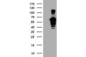 Western Blotting (WB) image for anti-Golgi Membrane Protein 1 (GOLM1) antibody (ABIN1498494)