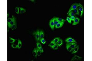 Immunofluorescence staining of HepG2 cells with ABIN7157976 at 1:100, counter-stained with DAPI. (LEMD1 Antikörper  (AA 44-151))