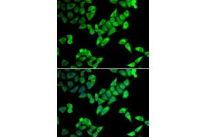 Immunofluorescence analysis of U2OS cells using TRIP10 antibody. (TRIP10 Antikörper  (AA 246-545))