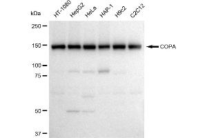 Western blotting analysis using COPA antibody (ABIN7798109).