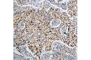 IHC analysis of PHF21A using anti-PHF21A antibody (ABIN6719353).
