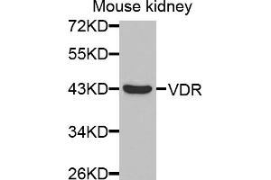 Western blot analysis of extracts of mouse kidney, using VDR antibody (ABIN5971220) at 1/1000 dilution. (Vitamin D Receptor Antikörper)