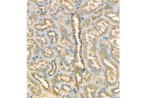 Immunohistochemistry of paraffin embedded mouse kidney using eIF5A2 (ABIN7073893) at dilution of 1:250 (400x lens) (EIF5A2 Antikörper)