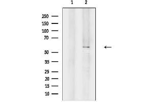 anti-POTE Ankyrin Domain Family, Member B (POTEB) antibody