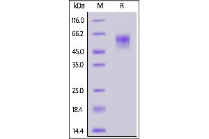SARS-CoV-2 S1 protein NTD, His Tag on  under reducing (R) condition. (SARS-CoV-2 Spike S1 Protein (B.1.351 - beta) (His tag))