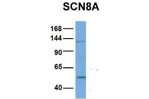 Host:  Rabbit  Target Name:  SCN8A  Sample Type:  NCI-H226  Antibody Dilution:  1.