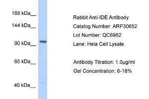 WB Suggested Anti-IDE Antibody   Titration: 1.