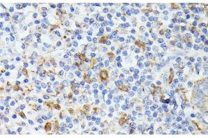 Immunohistochemistry (Paraffin-embedded Sections) (IHC (p)) image for anti-TIA1 Cytotoxic Granule-Associated RNA Binding Protein-Like 1 (TIAL1) antibody (ABIN7261938)