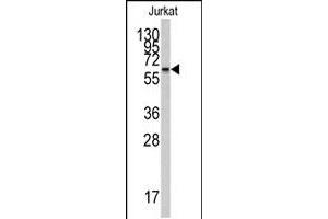 Western blot analysis of CYP26A1 polyclonal antibody  in Jurkat cell line lysates (35 ug/lane). (CYP26A1 Antikörper  (Internal Region))