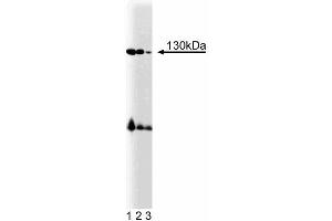 Western blot analysis of BMPR-II on mouse cerebrum lysate. (BMPR2 Antikörper  (AA 803-996))