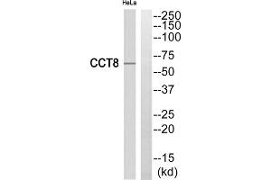 Western blot analysis of extracts from HeLa cells, using CCT8 antibody. (CCT8 Antikörper  (Internal Region))