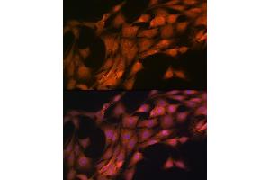 Immunofluorescence analysis of C6 cells using FKBP38/FKBP8 Rabbit mAb (ABIN7267214) at dilution of 1:100 (40x lens).