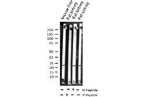 Western blot analysis of Phospho-Caveolin-1 (Tyr14) expression in various lysates (Caveolin-1 Antikörper  (pTyr14))