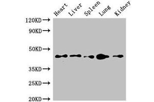 Western Blot Positive WB detected in: Mouse heart tissue, Mouse liver tissue, Mouse spleen tissue, Mouse lung tissue, Mouse kidney tissue All lanes: CD209 antibody at 4 μg/mL Secondary Goat polyclonal to rabbit IgG at 1/50000 dilution Predicted band size: 46, 36, 19, 44, 42, 31, 5, 38, 34 kDa Observed band size: 46 kDa (ITGB1 Antikörper  (AA 297-380))
