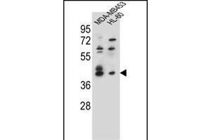 SOX3 Antibody (Center) (ABIN655392 and ABIN2844940) western blot analysis in MDA-M,HL-60 cell line lysates (35 μg/lane). (SOX3 Antikörper  (AA 166-196))