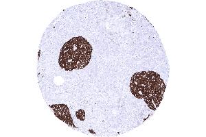 Pancreas A strong synaptophysin immunostaining is seen in islet cells of Langerhans (Rekombinanter Synaptophysin Antikörper  (AA 274-313))