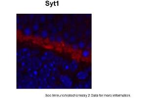Sample Type: complete mouse retina sectionsRed: PrimaryBlue: DAPIPrimary Dilution: 1:200Secondary Antibody: Goat anti-Rabbit AF568 IgG(H+L)Secondary Dilution: 1:200Image Submitted by: David ZenisekYale University