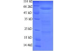 SDS-PAGE (SDS) image for RNA Binding Motif Protein, Y-Linked Family 1 Member A1 (RBMY1A1) (AA 1-459), (partial) protein (His tag) (ABIN5710752)