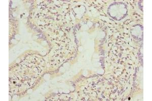 Immunohistochemistry of paraffin-embedded human small intestine tissue using ABIN7173167 at dilution of 1:100 (TMEM243 Antikörper  (AA 1-31))