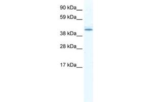 Western Blotting (WB) image for anti-DEAD (Asp-Glu-Ala-Asp) Box Polypeptide 49 (DDX49) antibody (ABIN2461354) (DDX49 Antikörper)