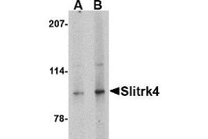 Western Blotting (WB) image for anti-SLIT and NTRK-Like Family, Member 4 (SLITRK4) (C-Term) antibody (ABIN1030684) (SLITRK4 Antikörper  (C-Term))