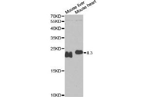 Western blot analysis of extracts of various cell lines, using IL3 antibody. (IL-3 Antikörper)