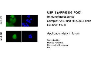 Immunofluorescence Sample Type: A549&HEK293T cellsPrimary Dilution: 1:500 (USP15 Antikörper  (C-Term))