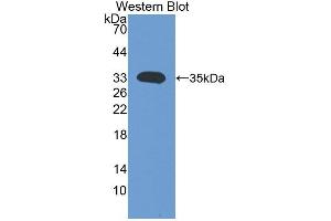 Western Blotting (WB) image for anti-Angiogenic Factor with G Patch and FHA Domains 1 (AGGF1) (AA 470-704) antibody (ABIN1866580)
