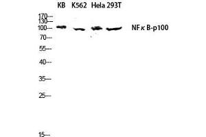 Western Blot (WB) analysis of KB K562 HeLa 293T lysis using NFkappaB-p100 antibody. (NFKB2 Antikörper  (Thr160))