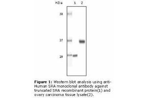 Image no. 2 for anti-Steroid Receptor RNA Activator 1 (SRA1) antibody (ABIN232100)