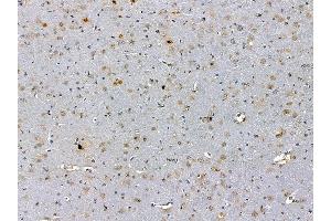 ABIN7095305 and ABIN7099362 at 1/100 staining rat brain tissue by IHC-P. (IRX5 Antikörper)
