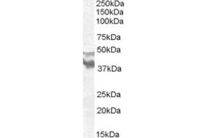 Image no. 1 for anti-Dyslexia Susceptibility 1 Candidate 1 (DYX1C1) (N-Term) antibody (ABIN374955) (DYX1C1 Antikörper  (N-Term))