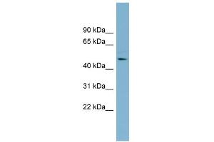 WB Suggested Anti-TMLHE Antibody Titration: 0. (TMLHE Antikörper  (Middle Region))