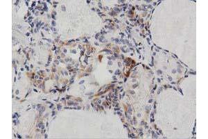 Immunohistochemical staining of paraffin-embedded Human liver tissue using anti-PECR mouse monoclonal antibody. (PECR Antikörper)