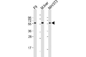 All lanes : Anti-Foxh1 Antibody (C-term) at 1:2000 dilution Lane 1: F9 whole cell lysates Lane 2: mouse liver lysates Lane 3: NIH/3T3 whole cell lysates Lysates/proteins at 20 μg per lane. (FOXH1 Antikörper  (C-Term))